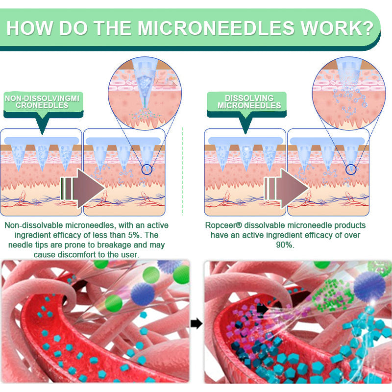 【Last Day Promotion 60% OFF🔥】Ropceer® NIDDK-Tirzepatide Slimming & health NANO MICRONEEDLE PATCH🇺🇸🔥(Zero Pain, 24/7 Release | Lose 20lbs FAST | 90% Sugar Drop | )