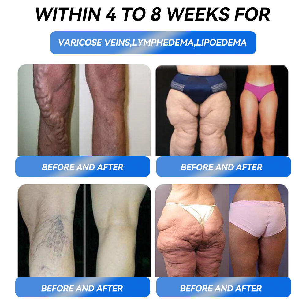 𝐓𝐡𝐨𝐧𝐞𝐬𝐫® 𝐆𝐋𝐏-𝟏 𝐏𝐫𝐨 𝐖𝐞𝐢𝐠𝐡𝐭 𝐋𝐨𝐬𝐬 𝐎𝐫𝐚𝐥 𝐒𝐨𝐥𝐮𝐭𝐢𝐨𝐧🛒7 days visible effect, no side effects, suitable for all age groups✔️