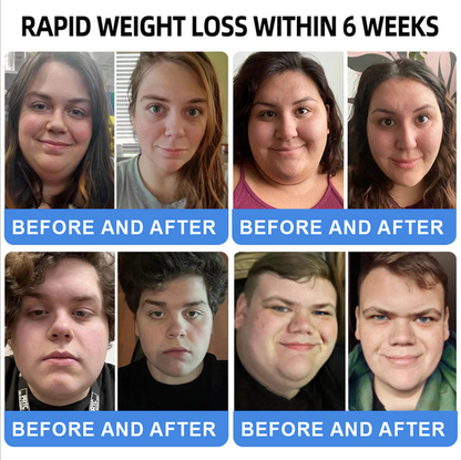 【Last Day Promotion 66% OFF🔥】 𝑪𝒗𝒓𝒆𝒐𝒛® NIDDK-Tirzepatide Oral Solution 🎉Use once every two days, | Lose 20 pounds quickly | Reduce sugar by 90% |)