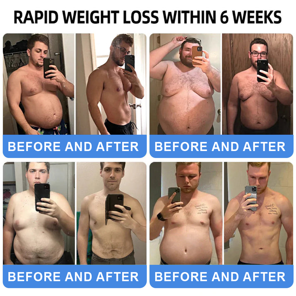 【Last Day Promotion 66% OFF🔥】 𝑪𝒗𝒓𝒆𝒐𝒛® NIDDK-Tirzepatide Oral Solution 🎉Use once every two days, | Lose 20 pounds quickly | Reduce sugar by 90% |)