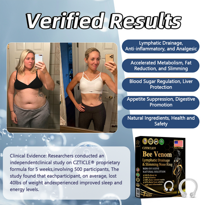 CZTICLE® Bee Venom Lymphatic Drainage & Slimming Nose Ring(🐝for all lymphatic problems and obesity)